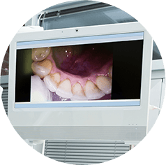 Intraoral Camera Odenton, MD