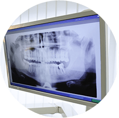 X-ray of Mouth Odenton, MD