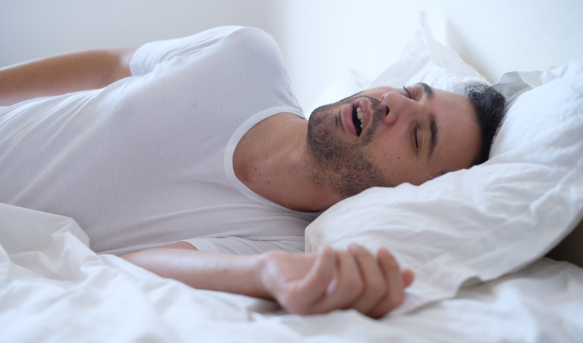 Man with sleep apnea sleeps with his mouth open on a bed with white sheets